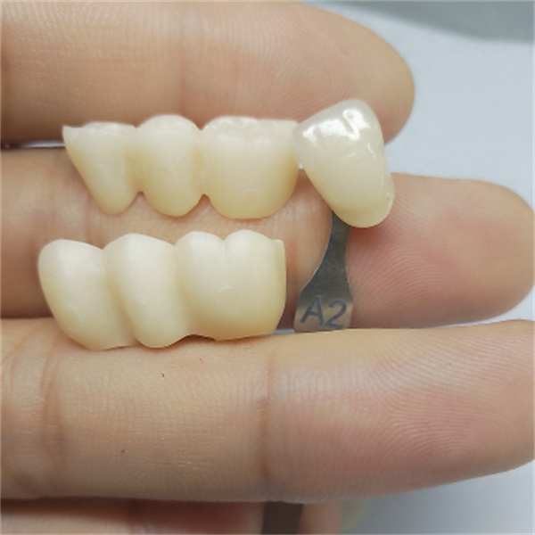 لماذا تعتبر كتل الزركونيا الخاصة بـ CAD/CAM الخيار الأفضل لأخصائيي طب الأسنان