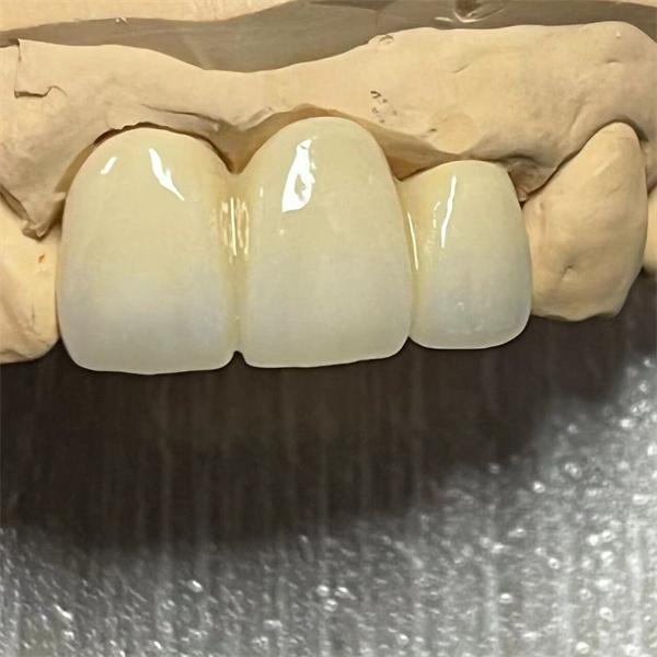Wide range of sizes and shapes available for all dental applications