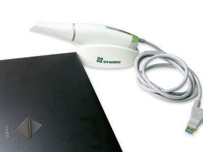 Futuro de las impresiones: El papel del escáner intraoral 3D