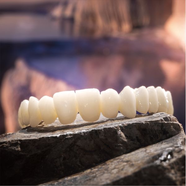 La Belleza y Longevidad de las Coronas y Puentes de Circonio Dental