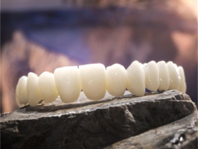 Cómo elegir la máquina de fresado de zirconia adecuada para su laboratorio dental