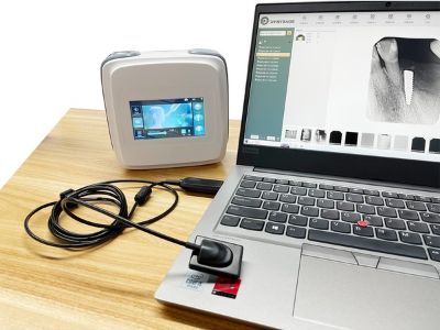 Sensores digitales de alta resolución para radiografías dentales para diagnóstico