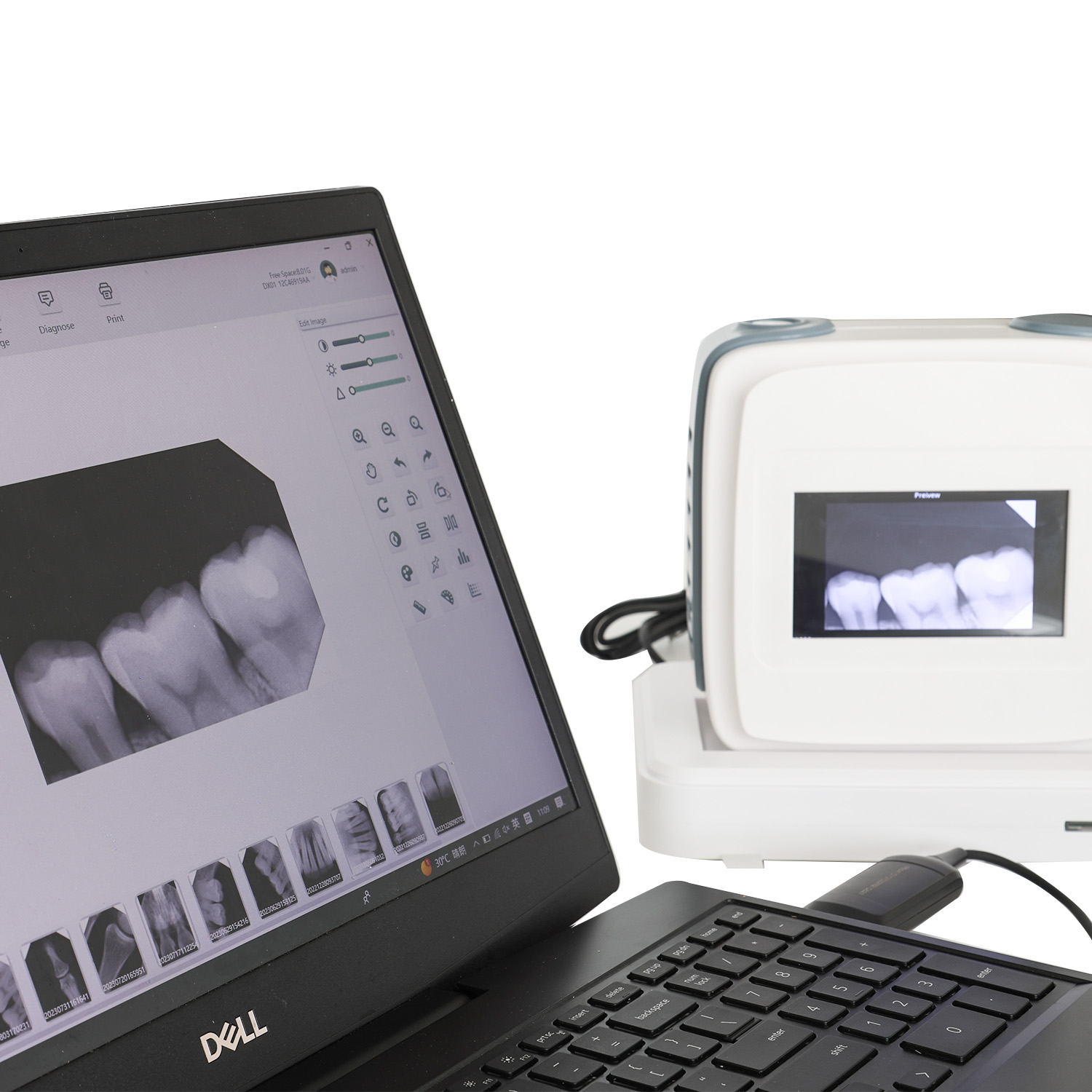 Principales beneficios del uso de una máquina de rayos X portátil en el diagnóstico médico