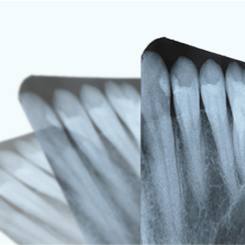 Tecnología Avanzada para Soluciones Superiores de Implantes Dentales