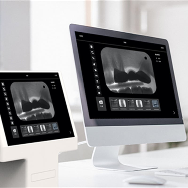 Sensores digitales frente a película para radiografías dentales: beneficios en ahorro de costes