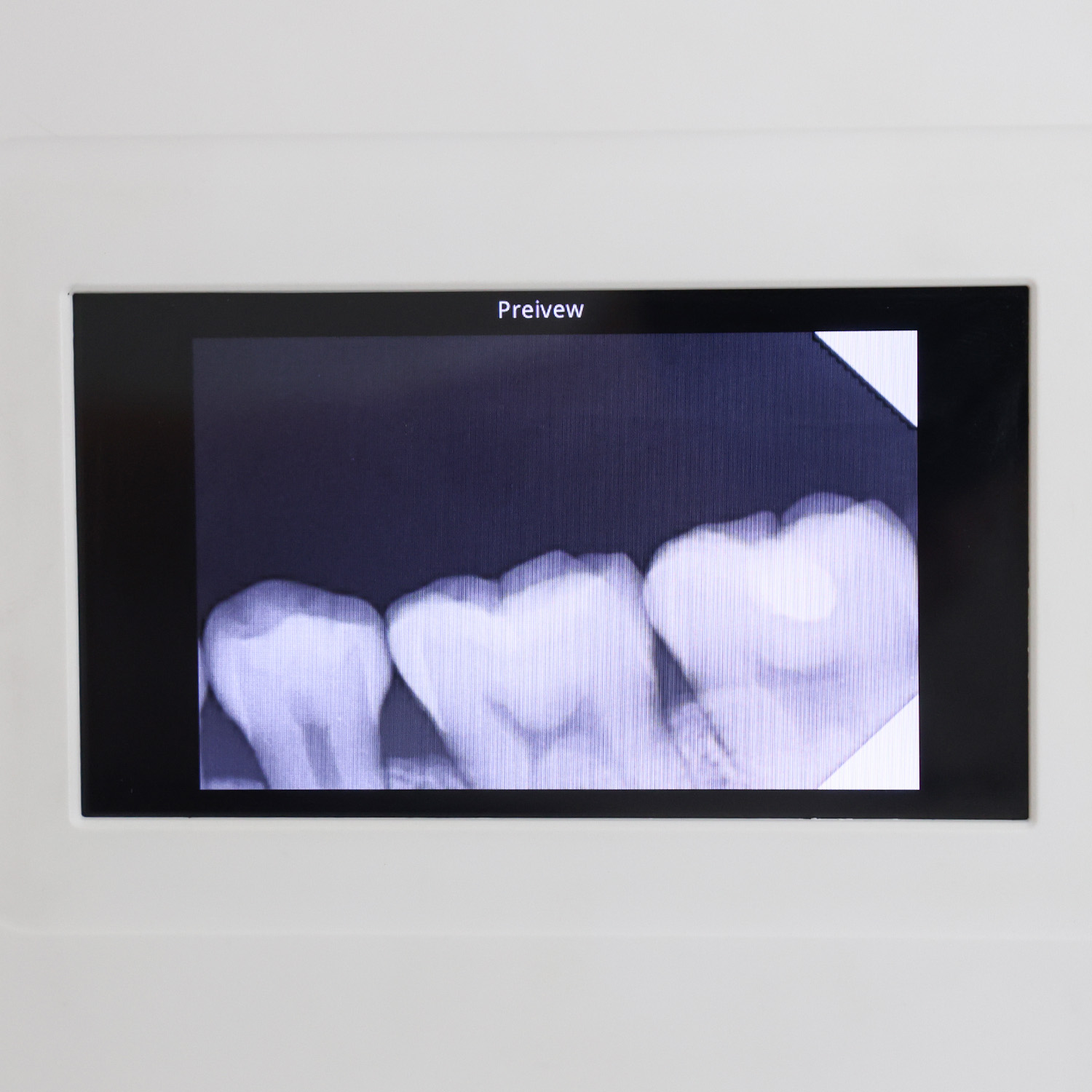 Sensores de Rayos X Dentales de Última Generación para Mejorar el Cuidado y el Diagnóstico del Paciente