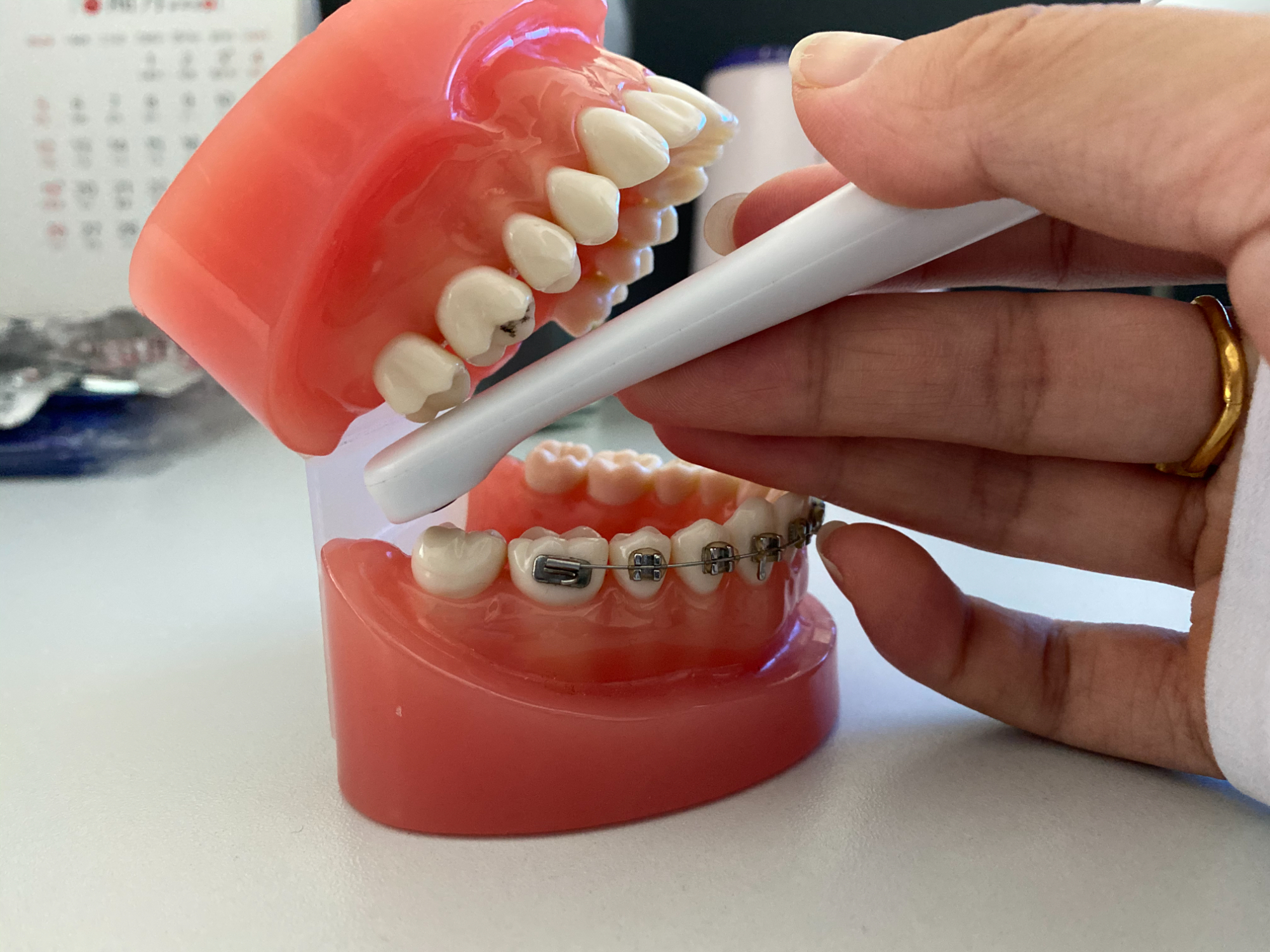 Excelencia en el Servicio y Garantía de Calidad de la Máquina de Rayos X Portátil: