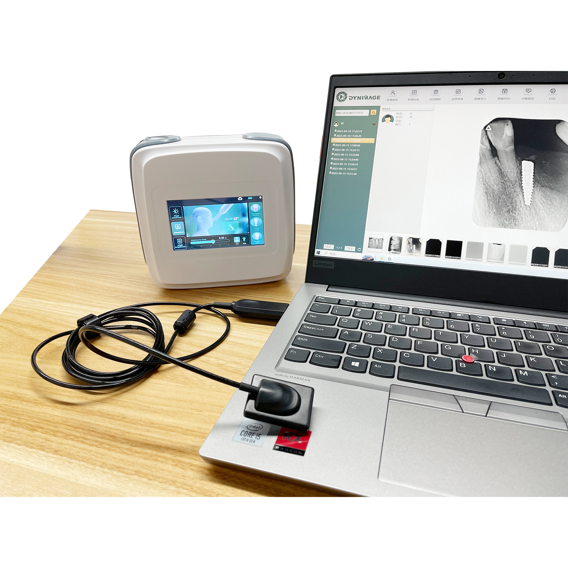 Explorando los beneficios del Escáner Digital de Dientes
