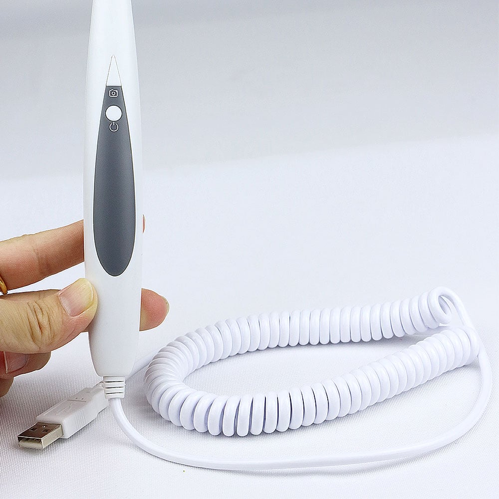Flujo de trabajo digital: Integración del escáner intraoral 3D en la práctica