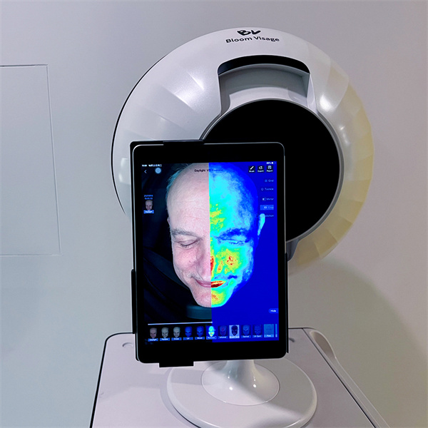 How Analyzing Your Skin Can Improve Your Facial Results