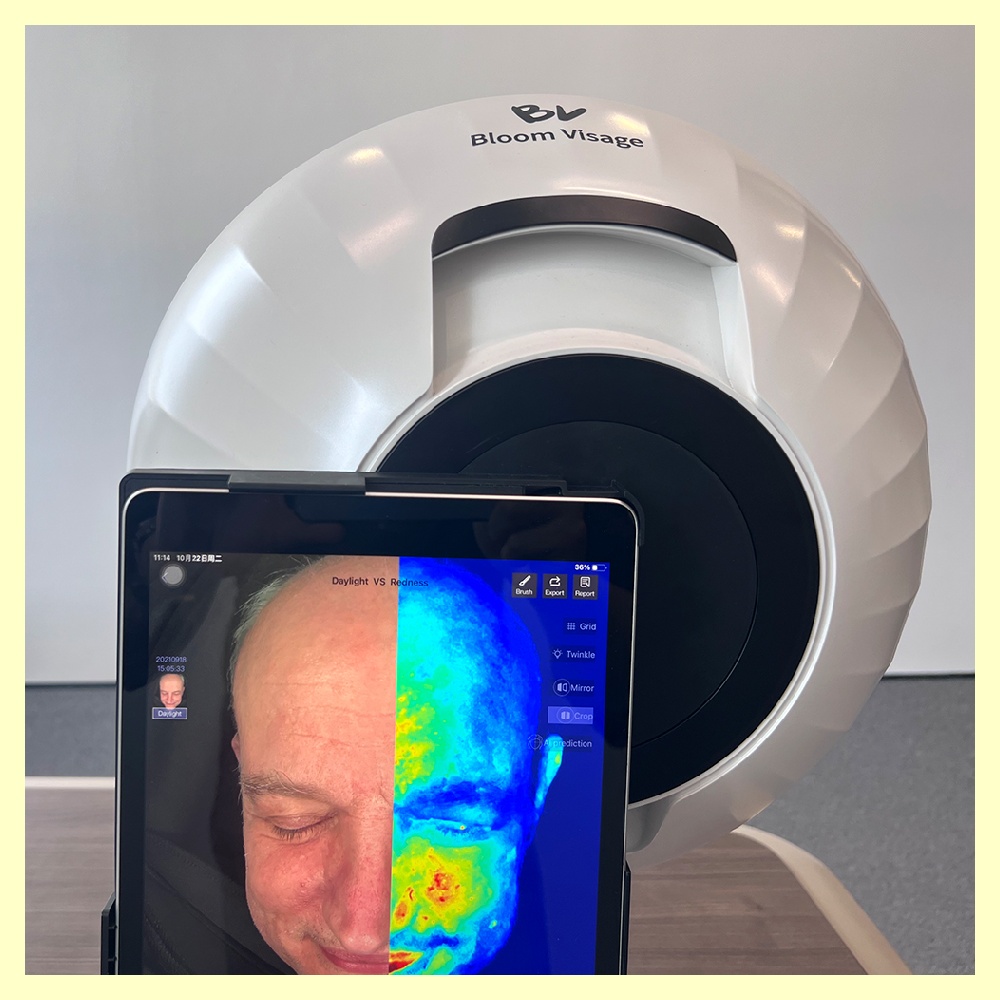 Discover the Health of Your Skin with Digital Skin Analyzer