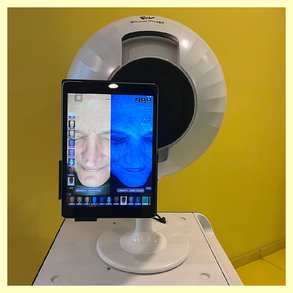 Skin Analyzer Device for Accurate Skin Analysis