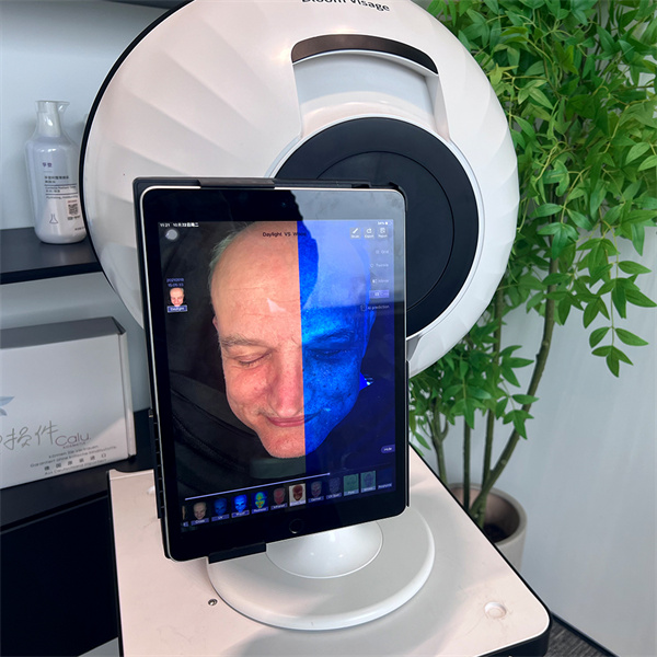 Transform Your Skin with Smart Skin Analyzer's Advanced Technology.