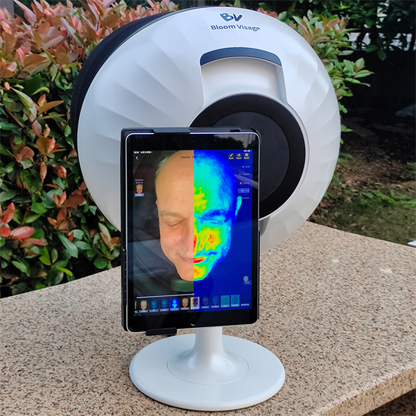 Scanning your way to beautiful skin
