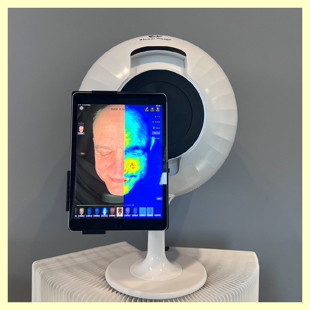 Skin Analyzer Price Guide to Get the Best Value for Your Money