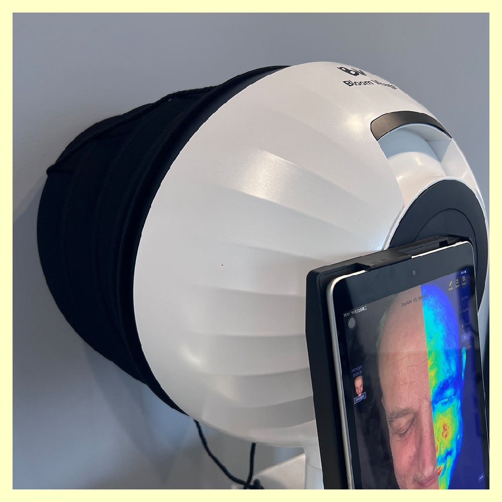 The science behind skin scope analysis - a closer look