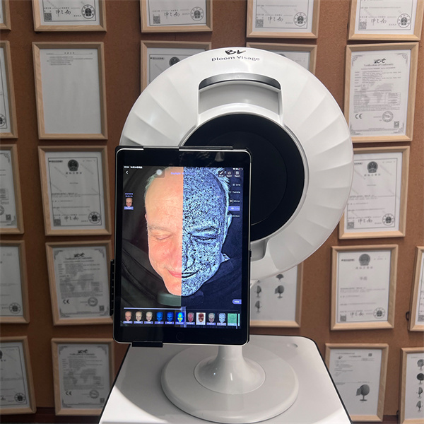 How Skin Photo Analysis can Transform Your Skin