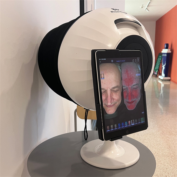Unravel the Mysteries of Your Skin with Face Mapping Analysis