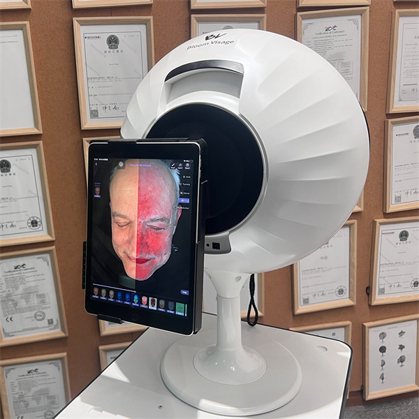 Transform Your Skincare Routine with a Skin Analysis Camera