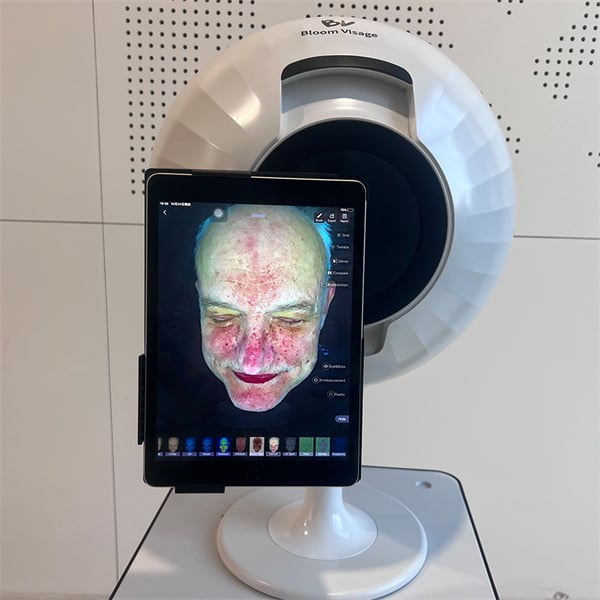 Instant Skin Analysis for Optimized Skincare