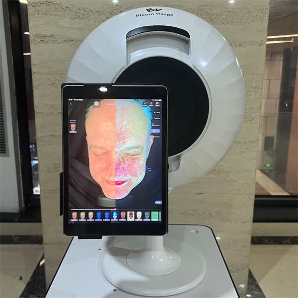 A Game-Changing Tool for Personalized Skincare
