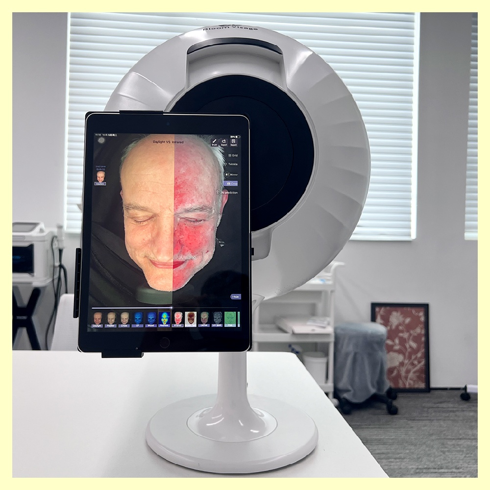Achieve Healthy and Glowing Hair with the Revolutionary Skin Diagnosis Hair Analyzer
