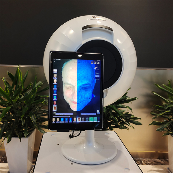 Discover Your Skin's True Health with AI Skin Analysis