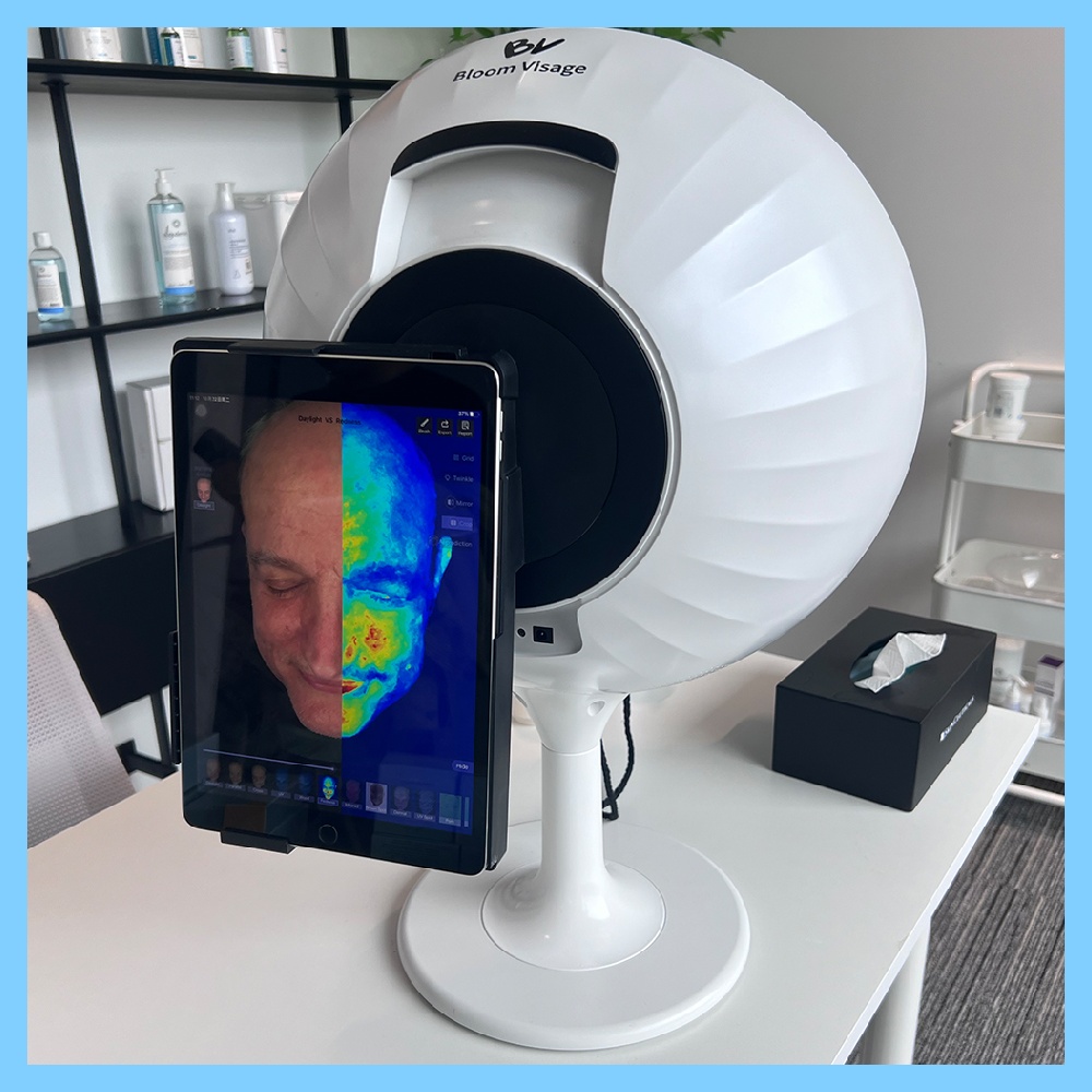 Maximize your skin health with the woods lamp skin analyzer