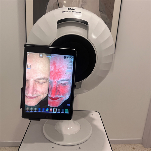 Zvýšete si sebevědomí přesnou analýzou krásy