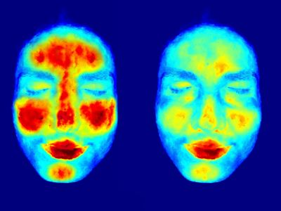 How 3D Skin Analysis Improves Treatment Personalization