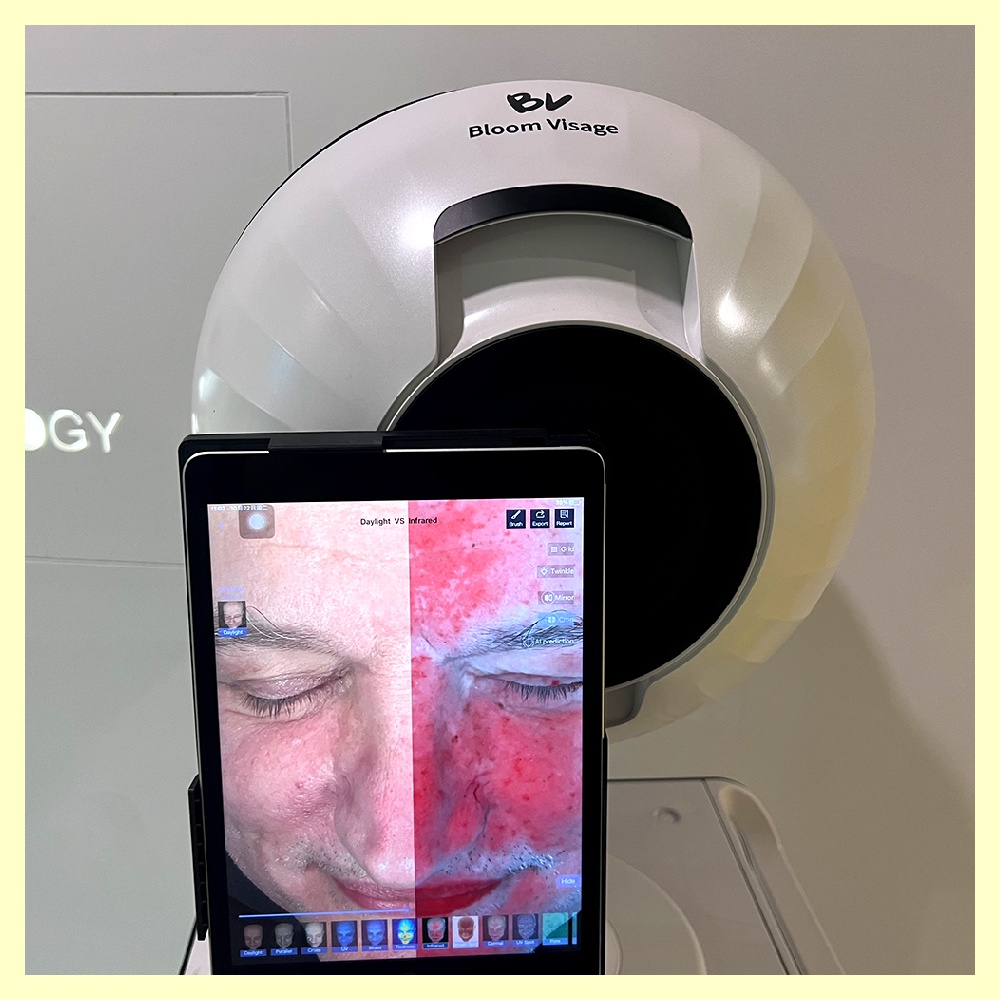 Maximize Your Skincare Routine with a Skin Moisture Meter