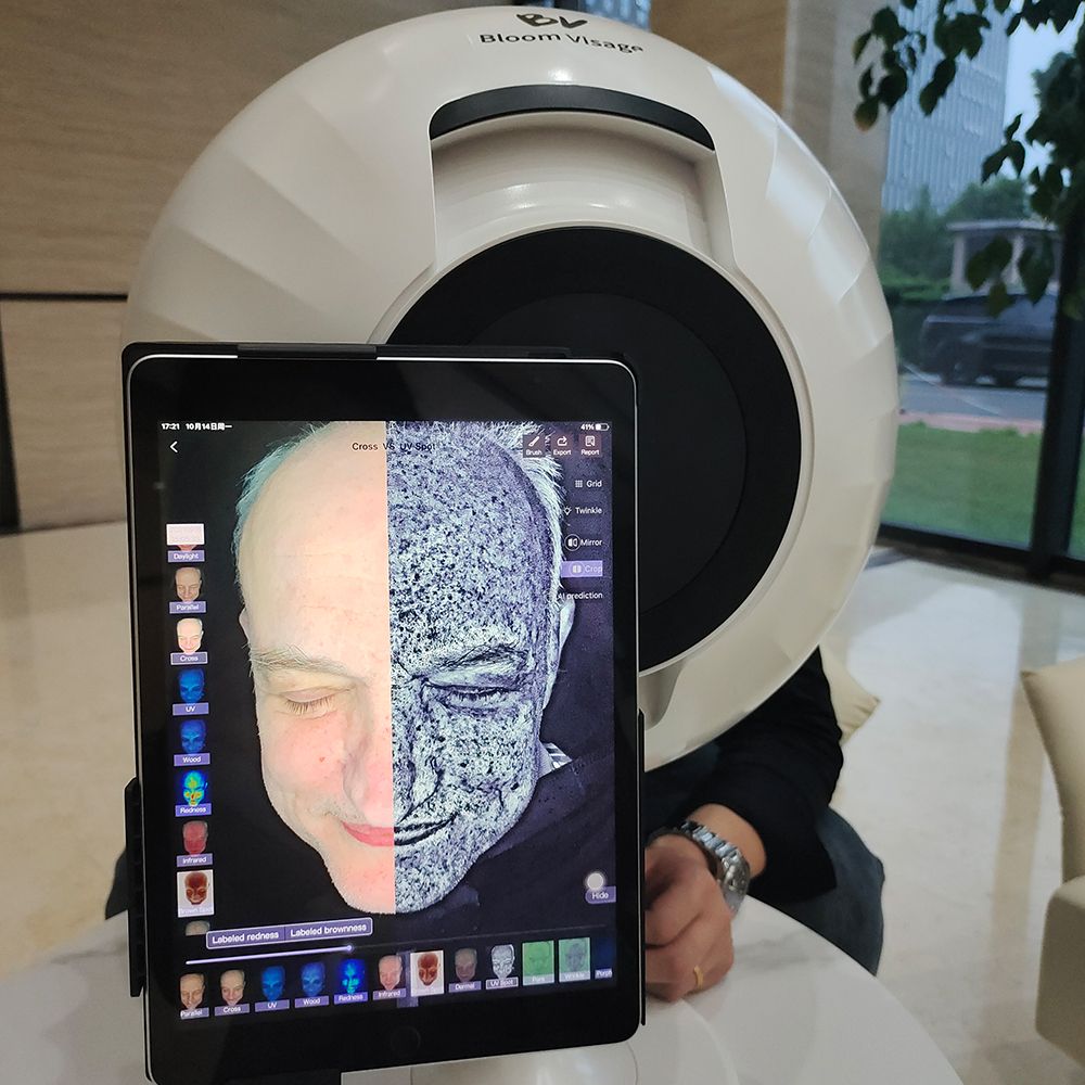 Revolutionize Your Beauty Routine With Skin Analysis