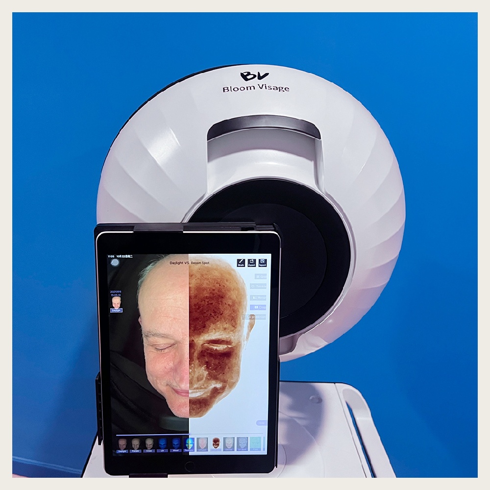AI skin analysis