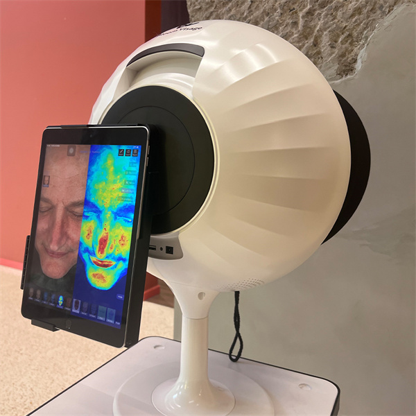 Say Goodbye to Guesswork with a Professional Skin Condition Analyzer