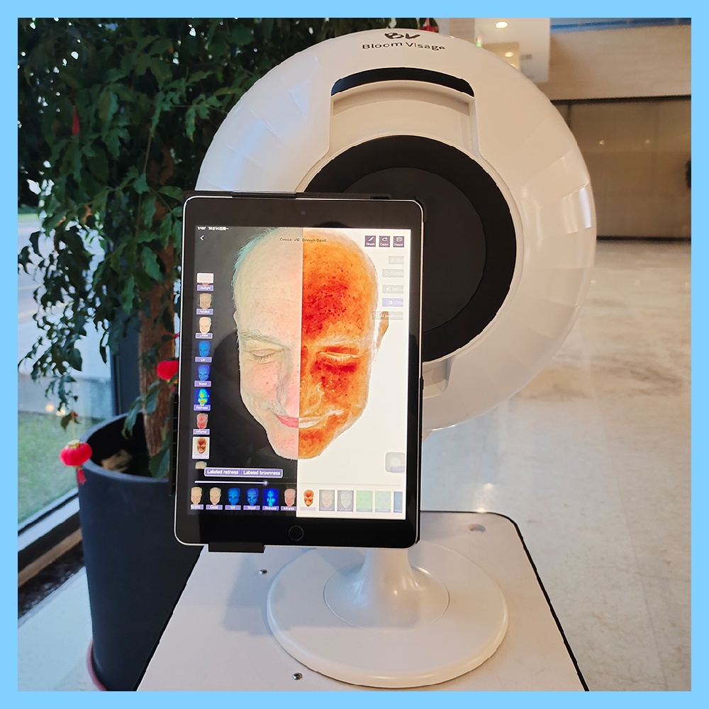Discovering the Key to Perfect Skin with an Advanced Digital Analyzer