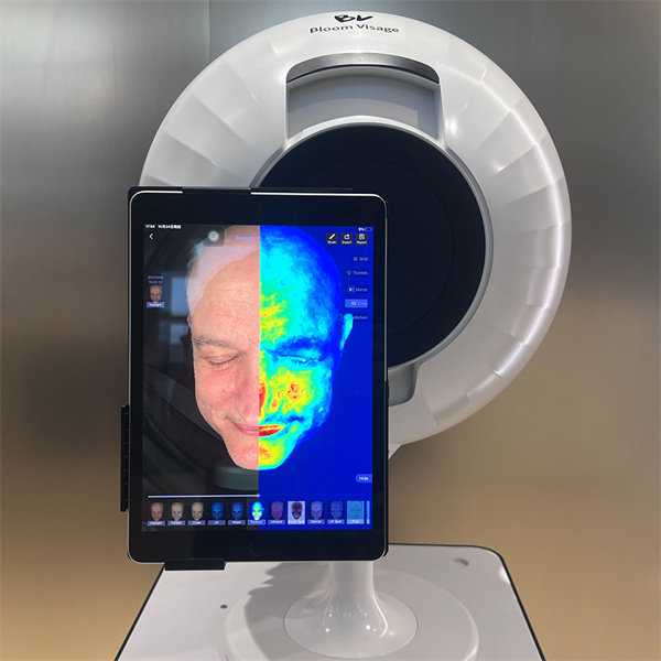 Enhance Your Skincare Routine with Accurate Skin Analysis Using SkinAnalyser
