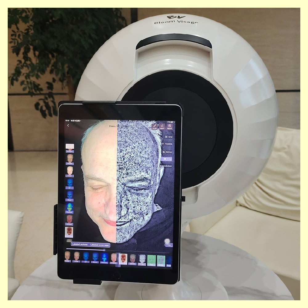 Say goodbye to guesswork - let our facial skin analyzer determine your personalized skincare needs