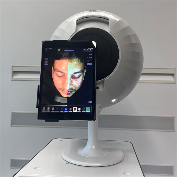 What a Skin Analyzer Test Can Reveal About Your Skin.