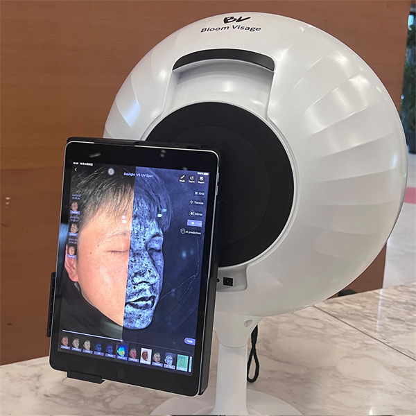 How Photography Technology Is Revolutionizing Skin Analysis