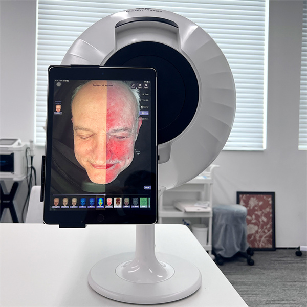 Navigating Skincare Just Got Easier with a Diagnostic Tool