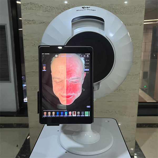 Unlocking the Secrets of Your Skin with Selfie Analysis