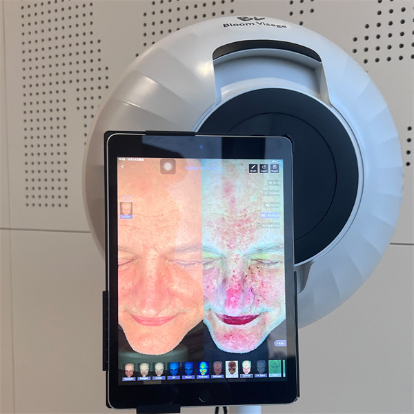 Advancing Healthcare with Cutting-Edge Face Scan AI Tools