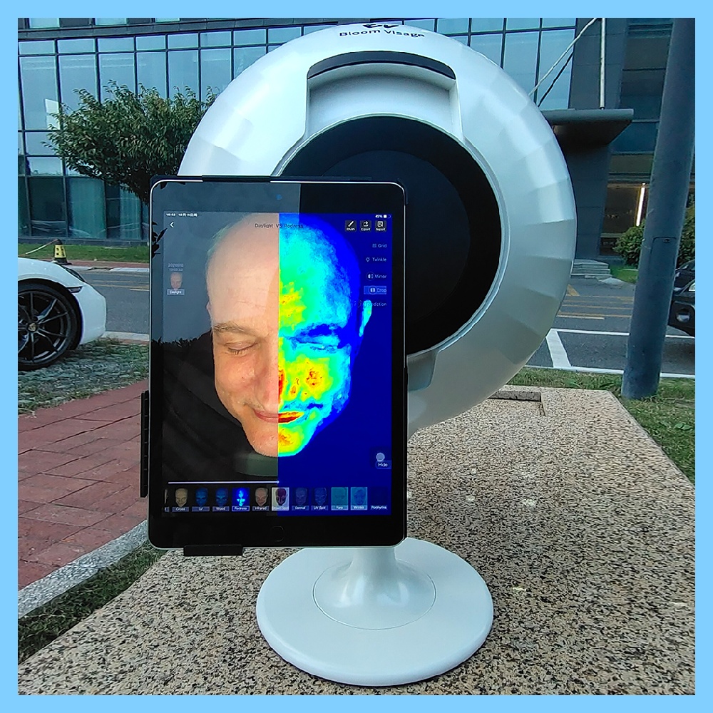 Advanced Technology for Personalized Skincare Analysis