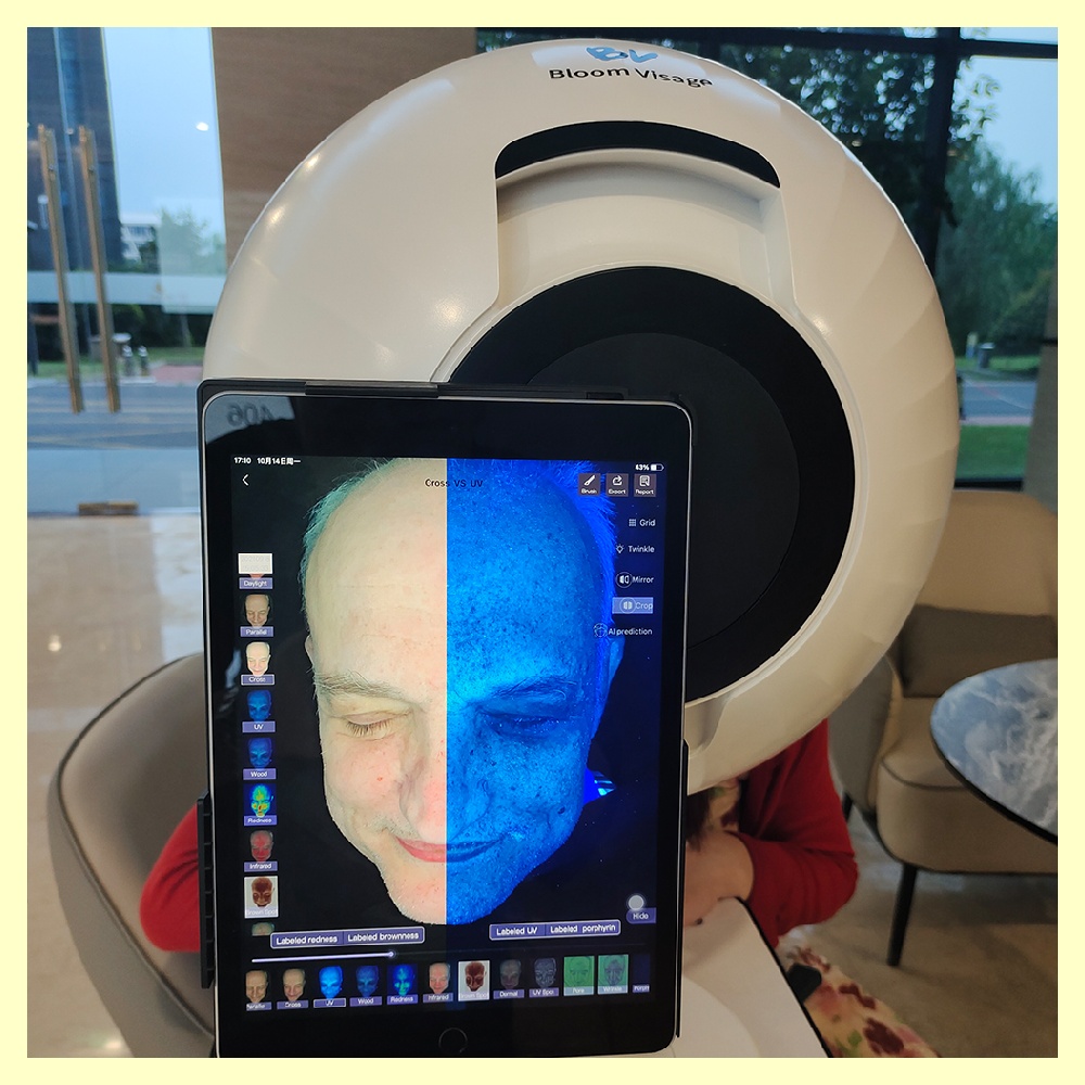 Get a Detailed Assessment of Your Skin Health with Face Skin Analyser