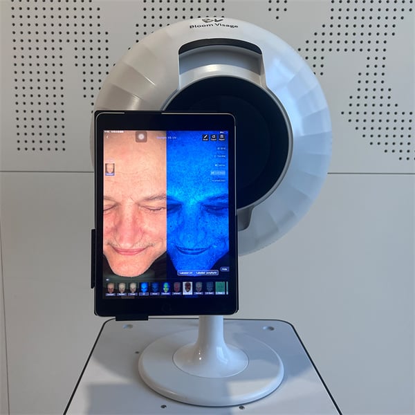 How a Skin Analyser Machine Enhances Beauty Regimens