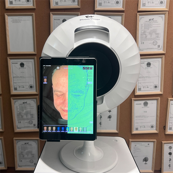 Elevate Your Skincare Consultations with Observ Skin Scanner