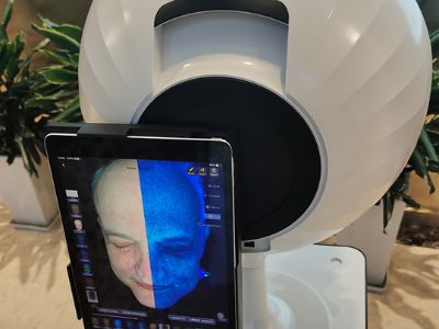 Tips for Selecting a Trustworthy Skin Analyzer Supplier