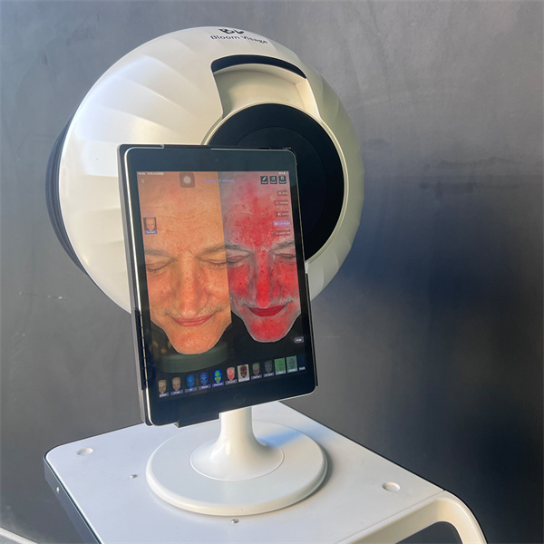 A Closer Look at Skin Detection Capabilities
