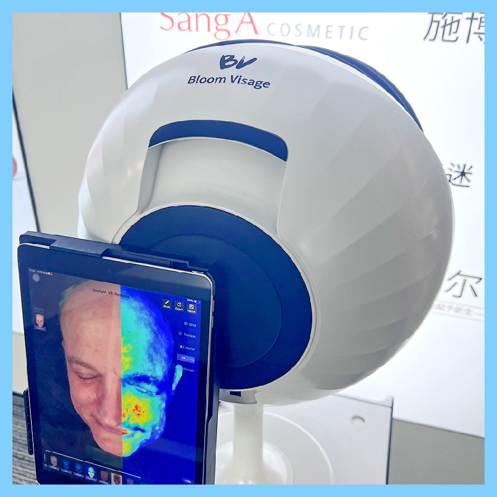 How a Skin Analyzer Device Reveals Hidden Skin Issues
