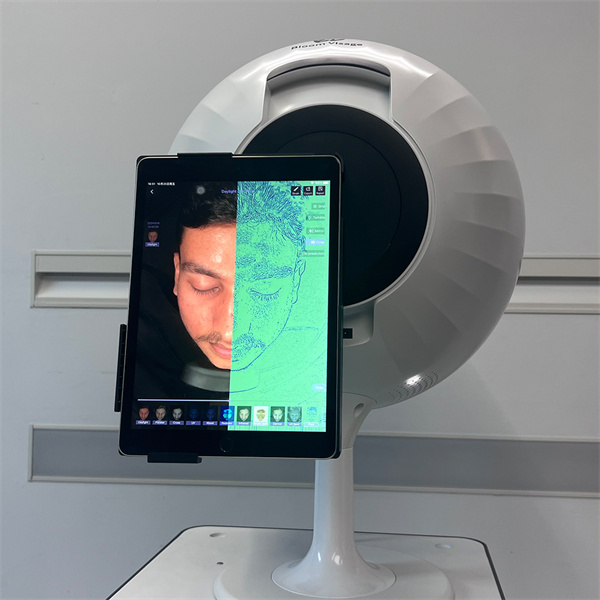 The Benefits of a Skin Analyzer Tes